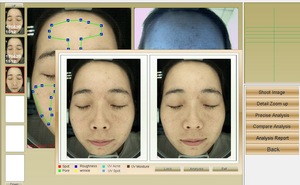 Hot sell magic mirror facial skin analyzer for beauty salon