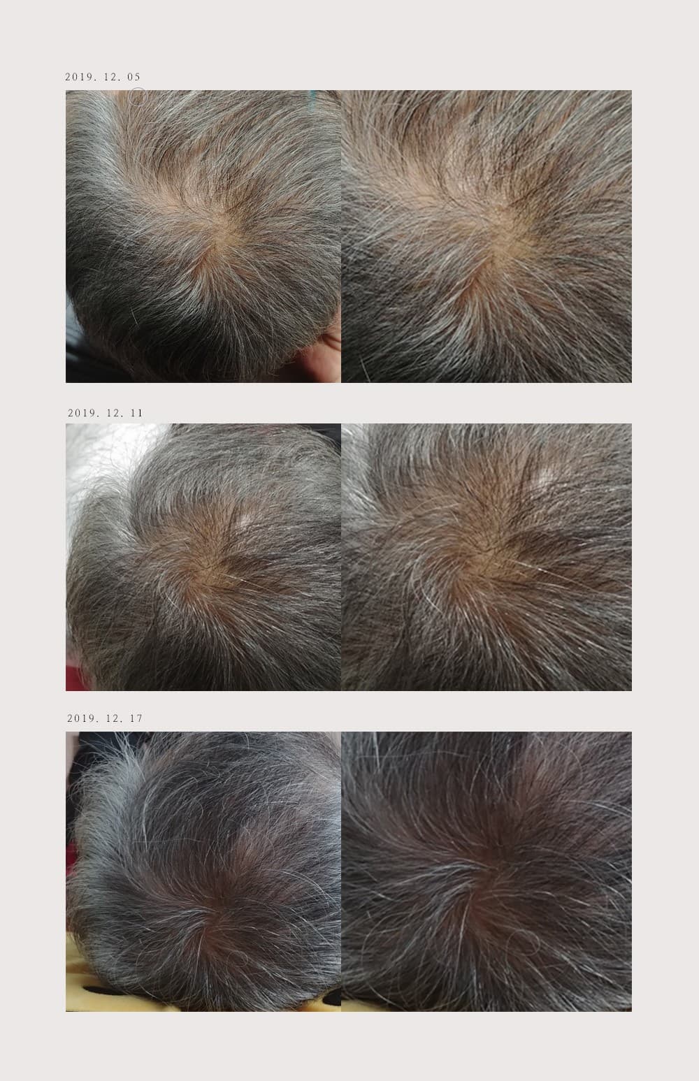 Promote hair growth, SUAAI rich black espoir shungite shampoo