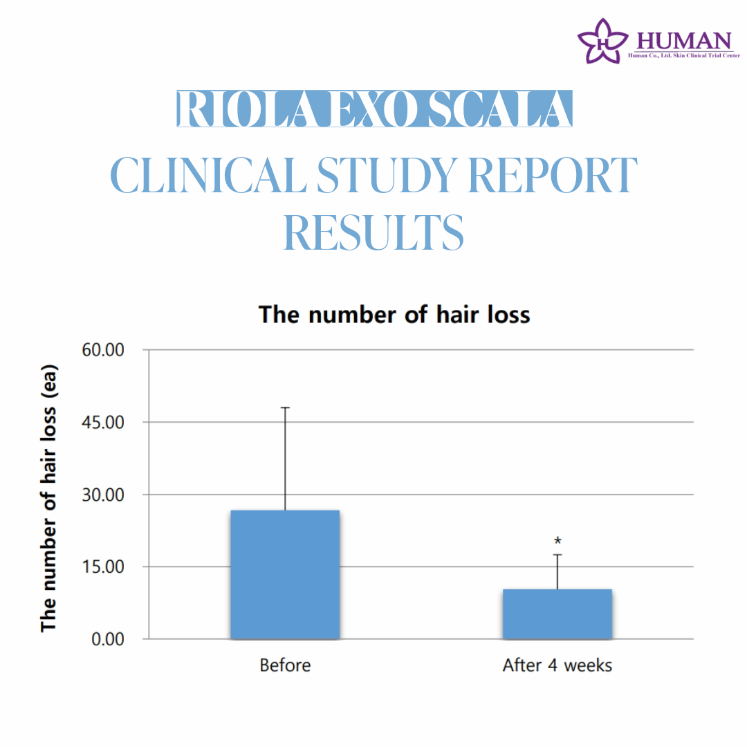 Riola Exo Scala Hair Loss Relief