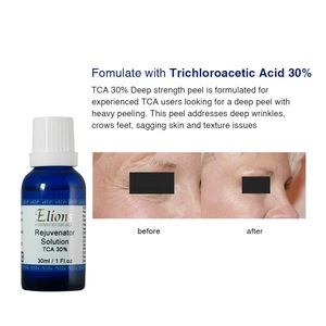 30%TCA Chemical Peeling Skin Care Whitening Serum