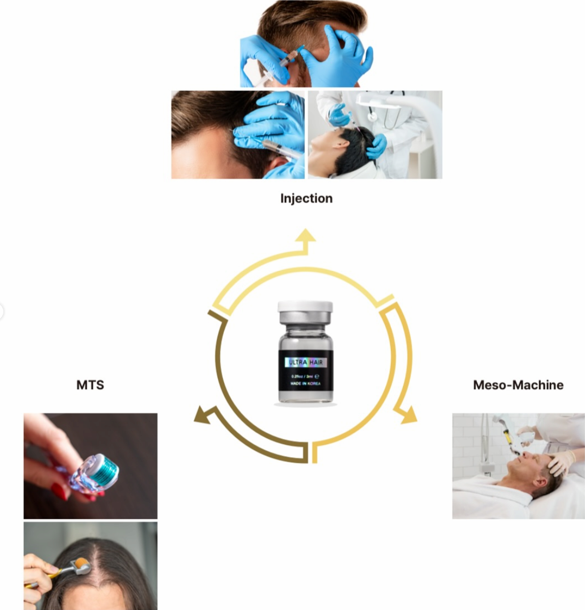 ULTRA HAIR  stem cell exosome-based hair loss treatment