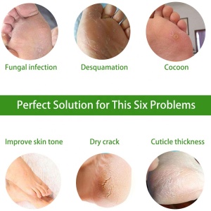 Custom Private Label Exfoliating Foot Mask Peeling Pack Mask Foot Peel Mask