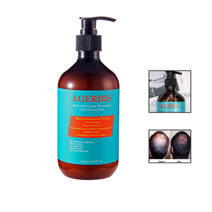 No Parabens Hair Regrow Products Softness Anti Hair Loss Shampoo Natural Shampoo