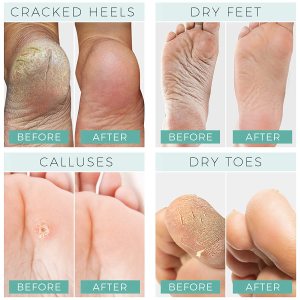 OEM Wholesale Korea Private Label Natural Organic Jasmine Feet Dry Skin Moisturizing Exfoliating Peeling Socks Foot Peel Mask