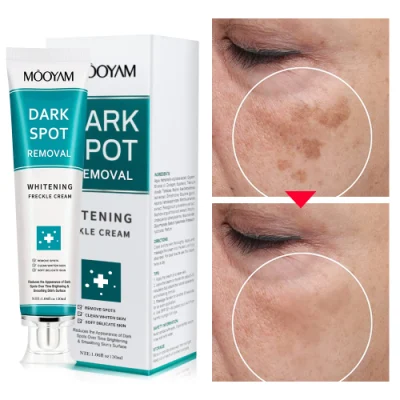 Wholesale Customize Own Brand Strong Whitening Freckle Cream Removal Melasma Dark Spot Melanin Remover Brighten Skin Face Cream