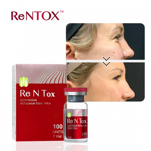 Botulax Nabota meditoxin injection type a botulinum toxin 100u wholesale