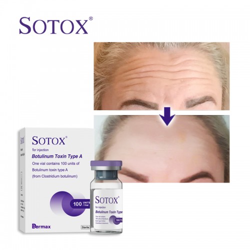 Sotox High Purity Botulinum Toxin 100u Made by Vacuum Drying Technology