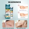 Nourishing and Moisturizing External Skin Scar Treatment Cream - Softening Scar Care Plaster