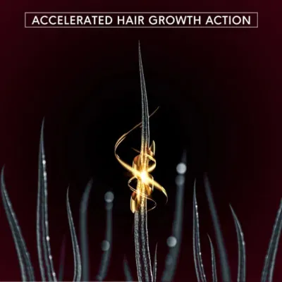 OEM/ODM Onion &amp; Bhringraj Regenerates Hair Follicleshair Growth Oil