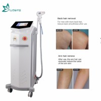 Diode Laser Hair Remove 808nm Beauty Machine for Medical Aesthetic