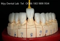 Chinese Dental Laboratory Dental lab in Shenzhen Implants dental lab