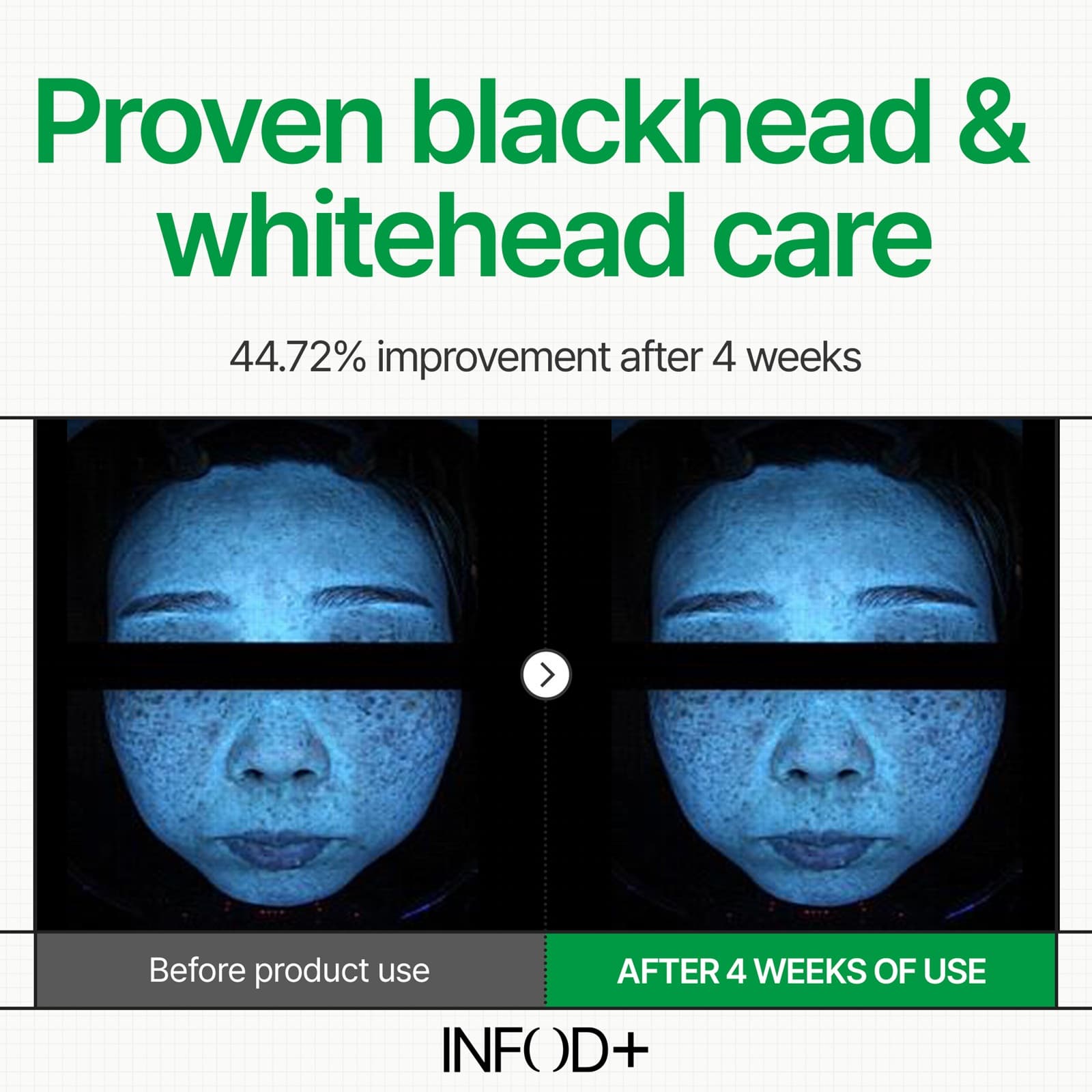 INFODPLUS XCESPI316™ HYDROVITA GEL PAD 70PADS