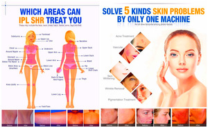 Laser Beauty Medical Machine Equipment  Best Selling Shr beauty equipment fda approved ipl machine