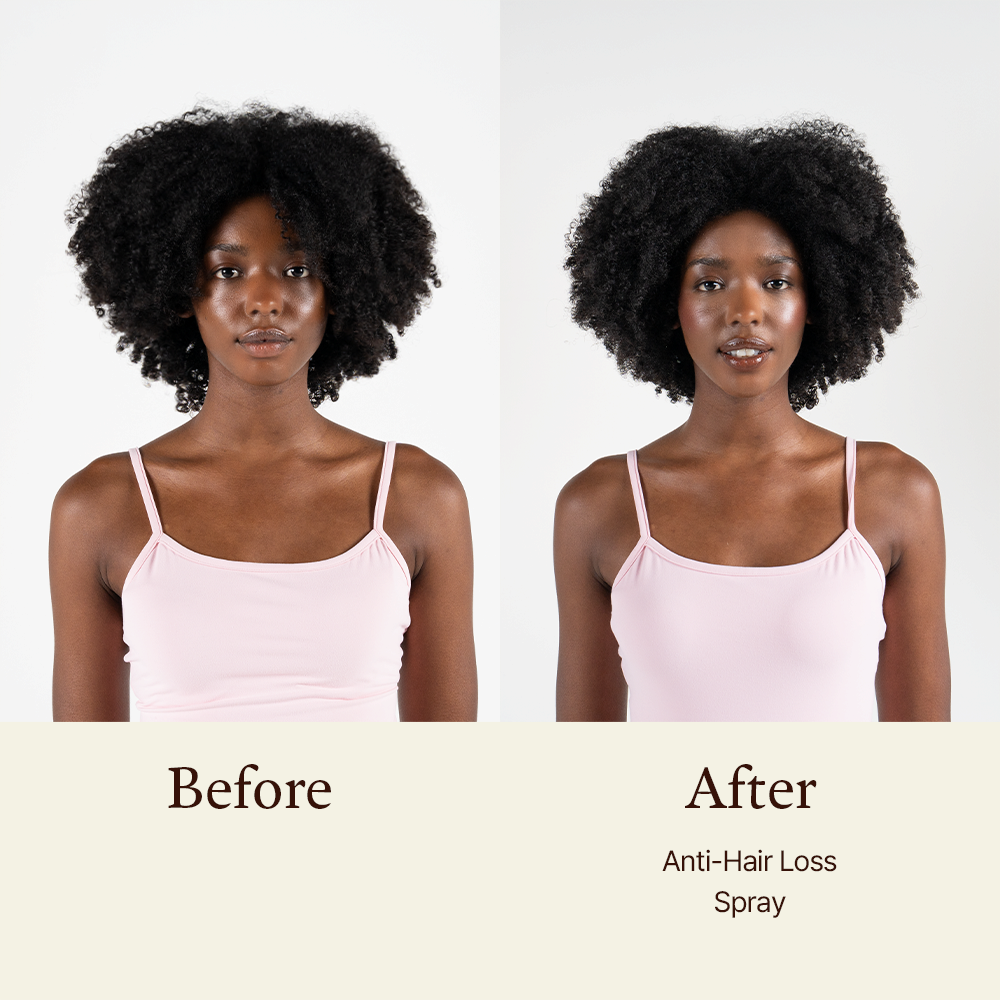 Morethan8 Anti-Hair Loss Spray with Matsutake Extract