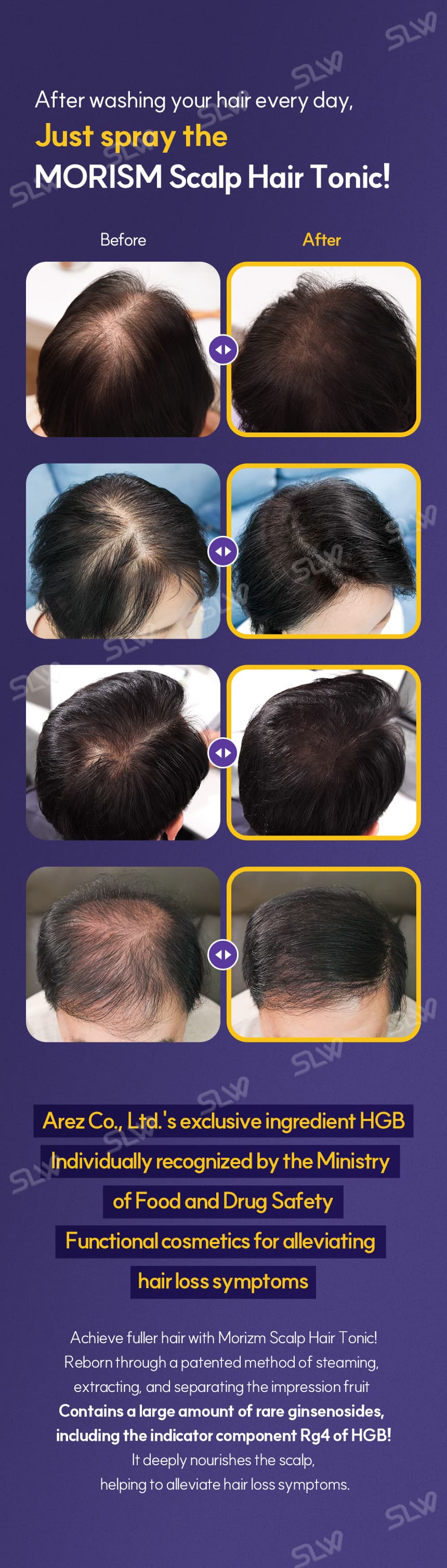 MORISM Scalp Hair Tonic