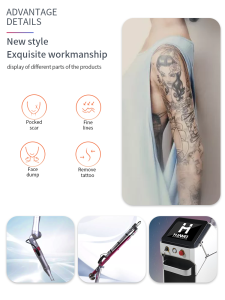 Q switched nd yag laser /tattoo removal beauty machine /laser tattoo removal nd yag laser q-switched nd:yag laser