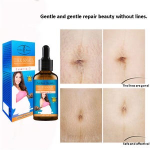 Aichun Beauty body repair 100% Natural The snail Scar Removal Fast removes Stretch Mark Essential Oil