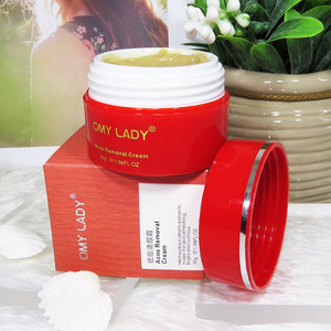 OMY LADY Herbal Beauty Skin Cream for Acne Scar Removing OEM/private label/free sample