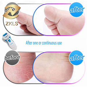 Powerful Electric Foot Callus Remover Rechargeable Electronic Pedicure Foot File Removes Best Foot Care Tool