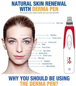 Acne Scar Removal Micro Needle Therapy Dermaroller Electric 12 In 1 derma pen