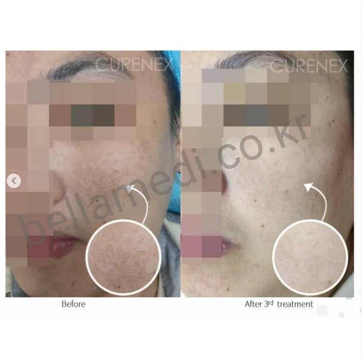 CURENEX PDRN COLLAGEN WHITENING