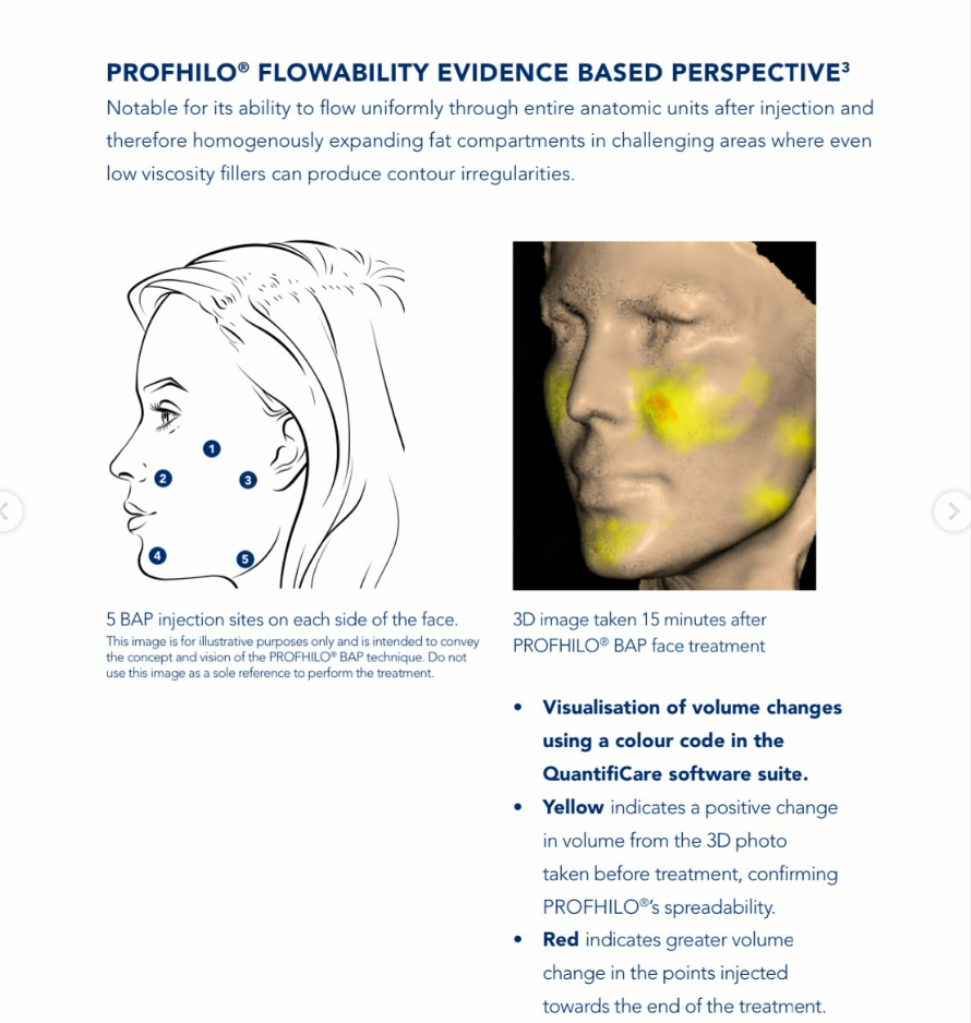 PROFHILO  H-HA + L+HA  Hydrolift, Collagen Stimulation 