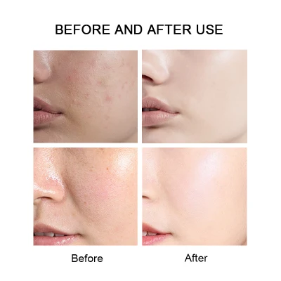 Wholesale Factory Custom Logo Natural Face Care Skin Brightening Anti-Acne Turmeric Face Cream