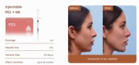 Injectable PCL+HA