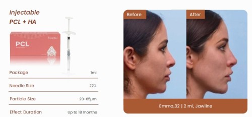 Injectable PCL+HA