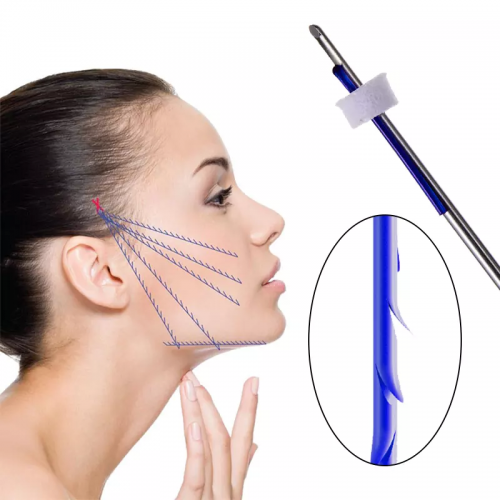 Professional Beautlift Triangle Cog Thread for Face Nose Neck Lifting