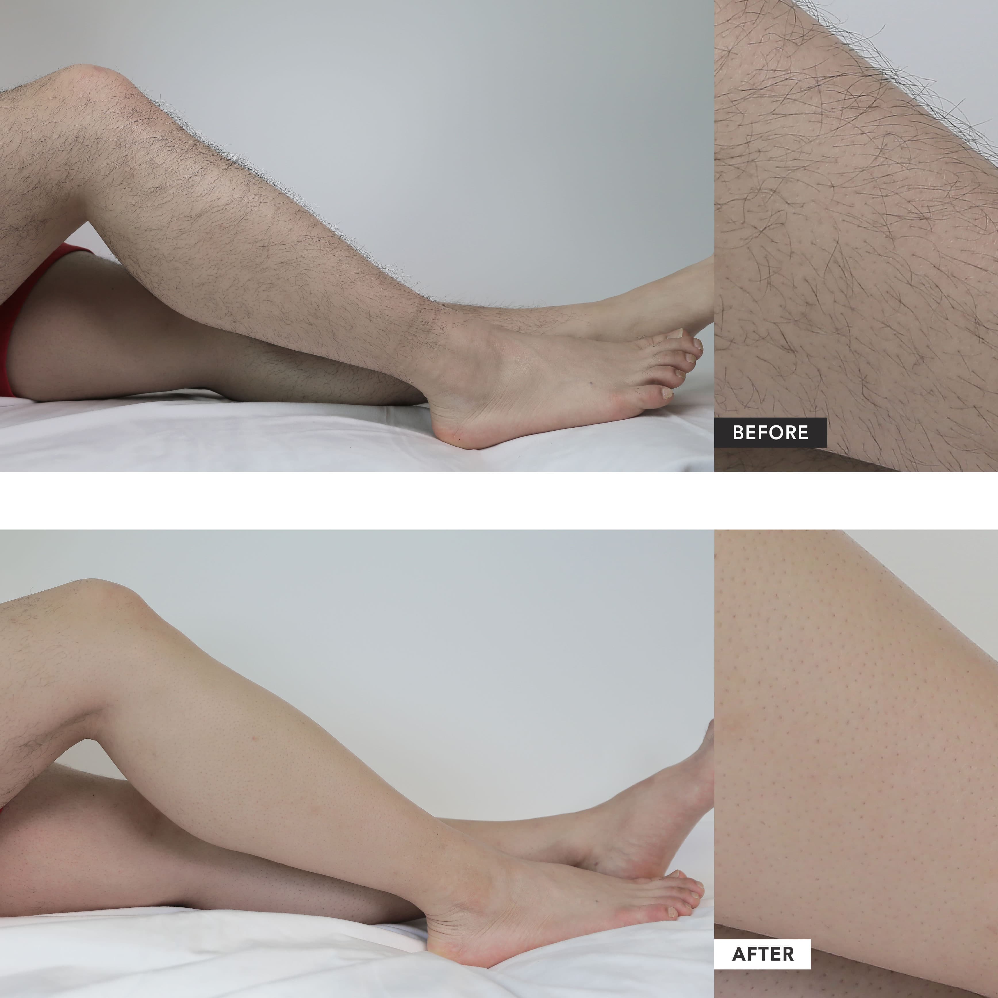 ALLIONE HAIR REMOVAL CREAM 2sku
