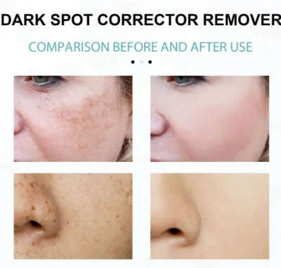 Collagen Cream Whitening Freckle Cream Melasma Remove Legs/Arms Face Dark Spot Corrector Cream