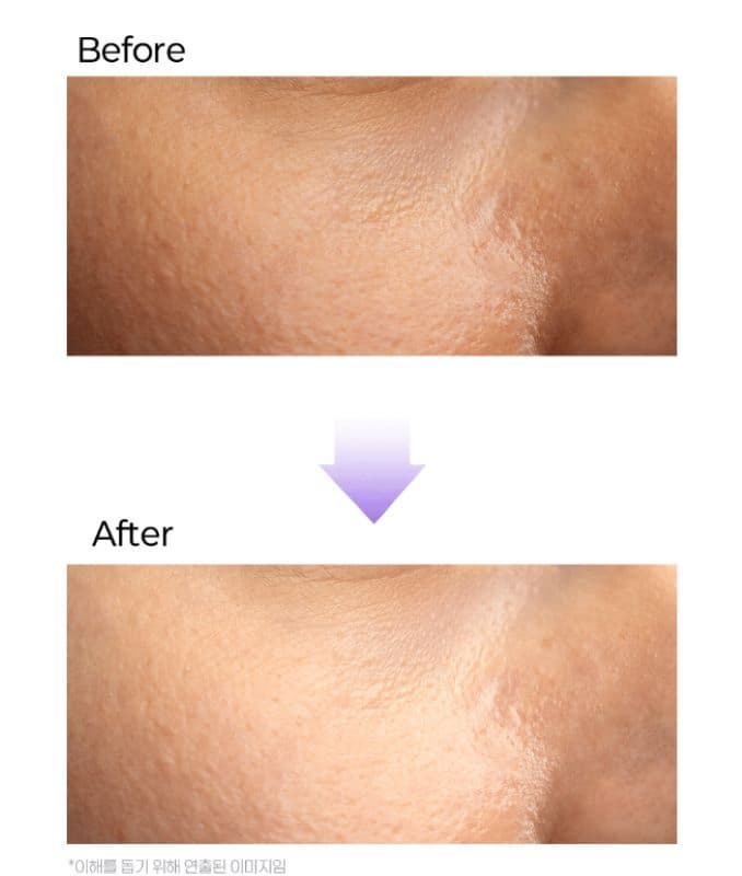 Glutathione Ampoule