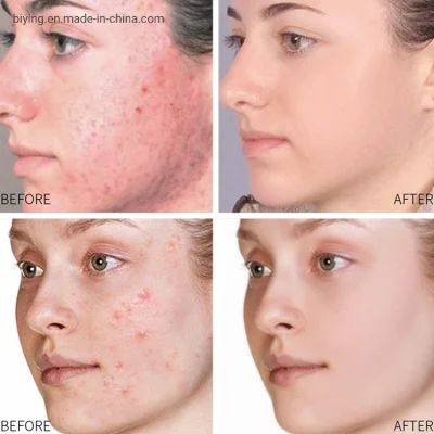 OEM Skin Care Anti Wrinkle Skin Whitening Anti Aging Vitamin C Facial Serum Set Gold Hyaluronic Acid Face Essence
