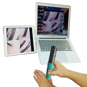 Suitable For A Variety Of System 600X Handheld Mini scalp Analyzer