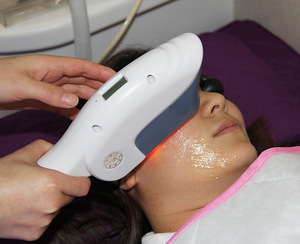 CE approved ipl intense pulsed light machine