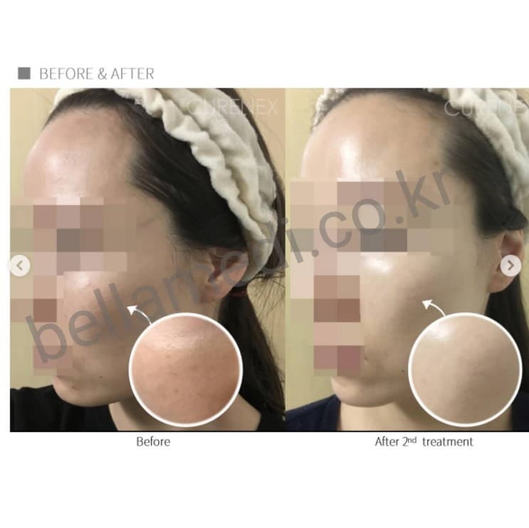 CURENEX PDRN COLLAGEN WHITENING
