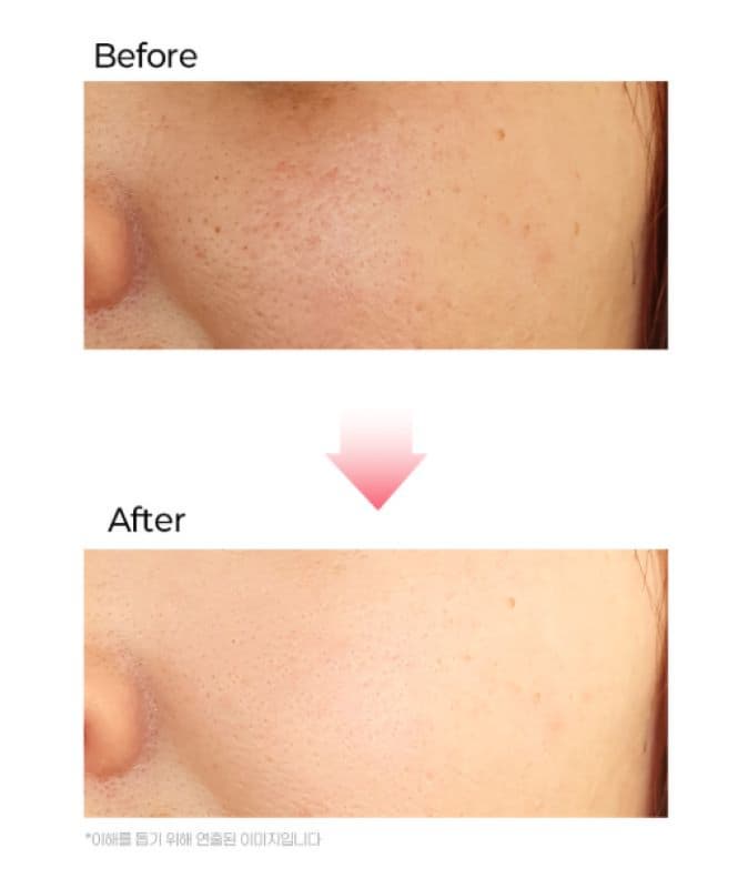 EGF Ampoule