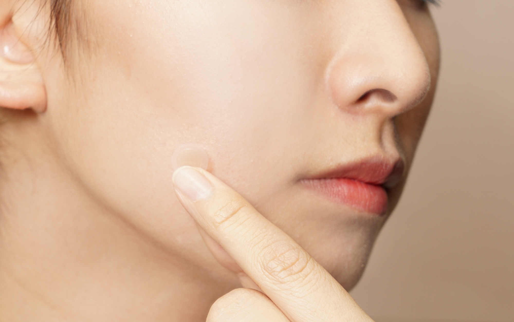homemedicare spot patch (acne patch, pimple patch)
