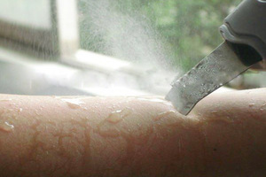 skin rejuvenation ultrasonic peeling cleaning machine skin scrubber