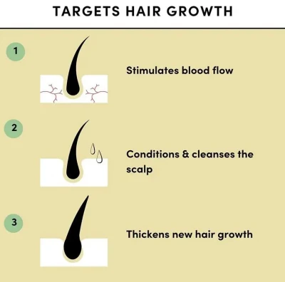 Wholesale Organic Fast Anti Hair Loss Treatment Regrowth Healthy Strong Biotin Hair Oil Hair Growth Serum