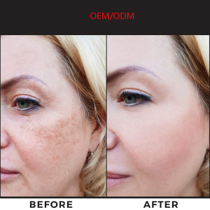 Arbutin Whitening Face Cream Dark Spot Corrector Melasma Treatment Fade Cream