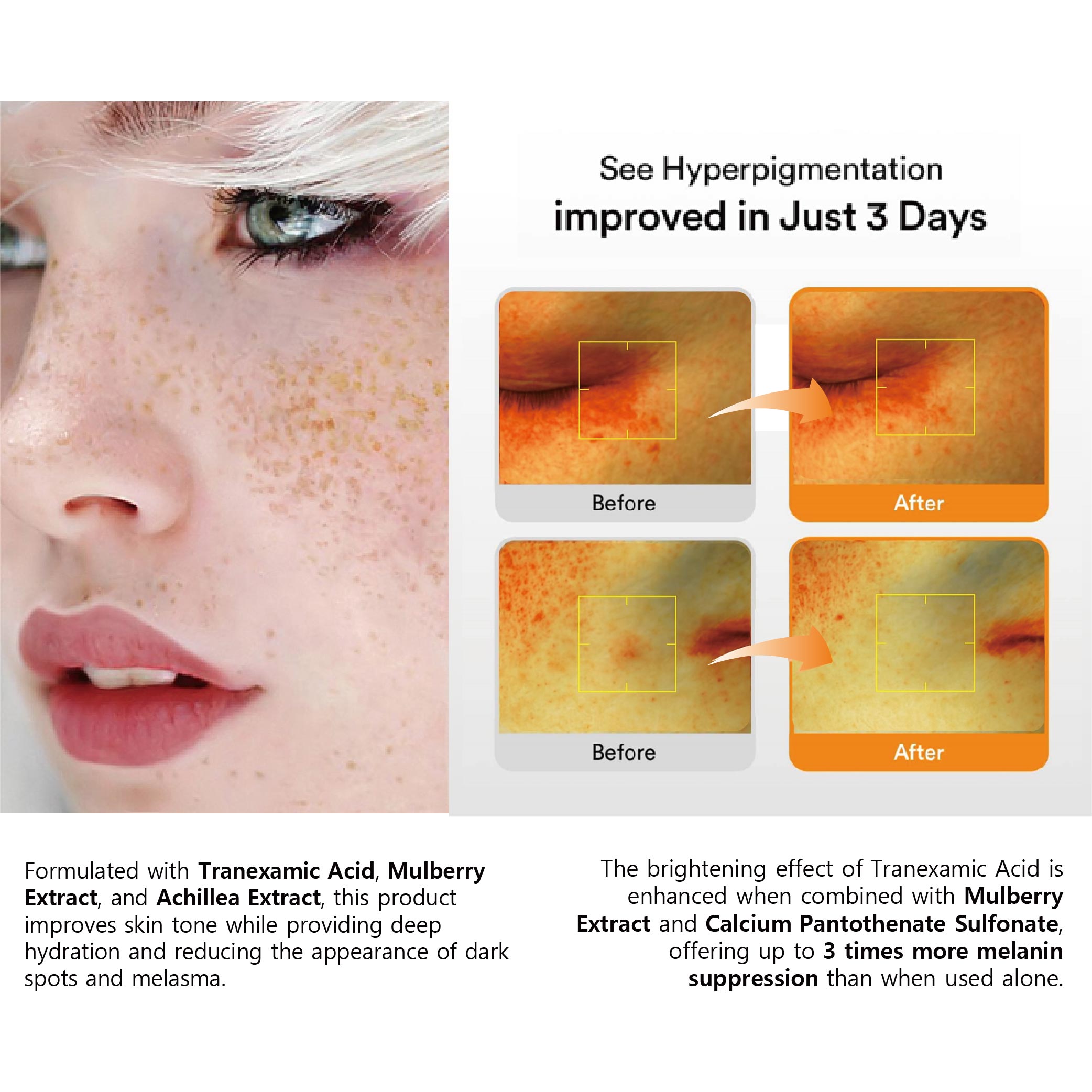 BRIGHT CREAM (Skin Care)