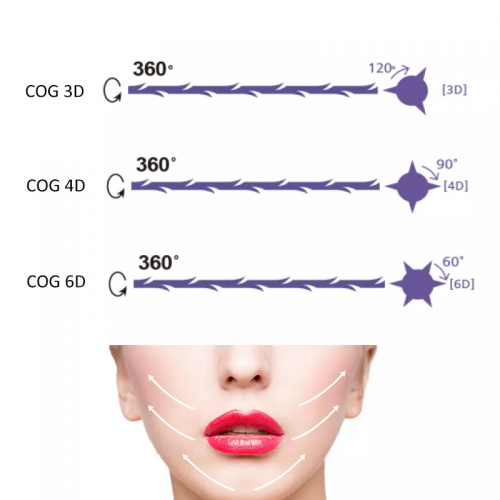 Best Price Cog Pdo Thread Lift L Cannula Thread Pdo Thread Lift Korea for Face Lifting