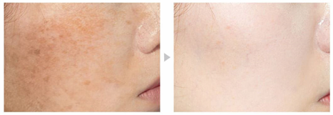 [MAY ISLAND]7DAYS SECRET VITA PLUS-10 TONER 155ml