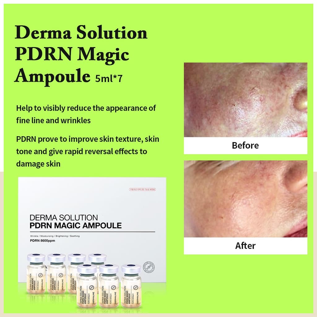PDRN Magic Ampouple SET