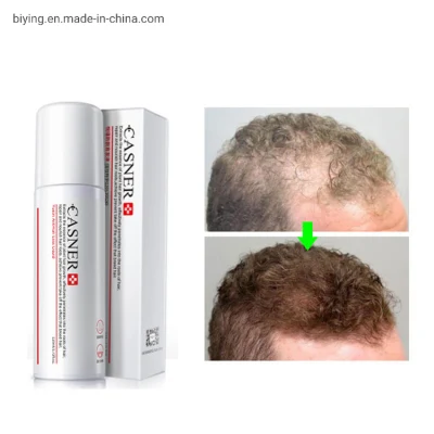 Private Label Hair Care Regrowth Hair Loss Treatment Bald Hair Regrowth Effective Hair Growth Spray