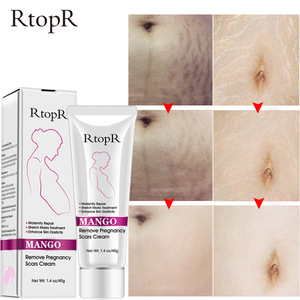 RtopR Natural Herbal Mango Anti Scar Cream Anti Wrinkle Maternity Repair Firming Fast Effective Anti Stretch Marks Cream