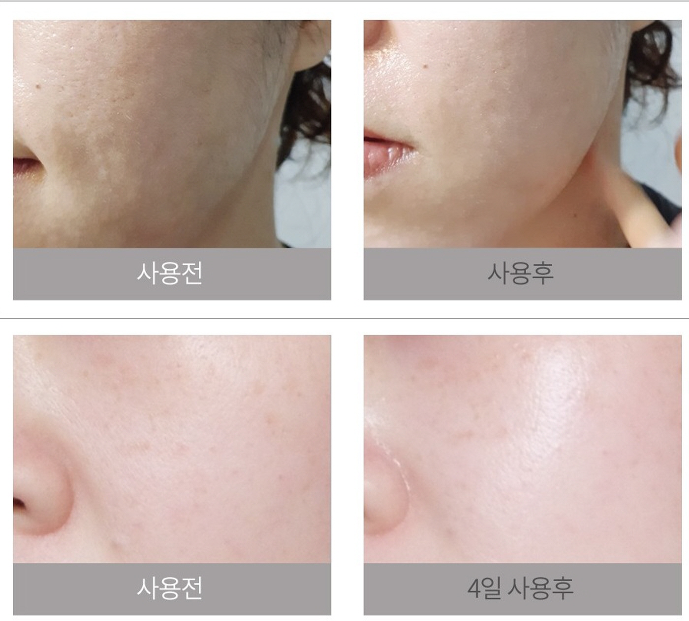 Kranicell 3rd Generation Bifida Complex Repair Serum