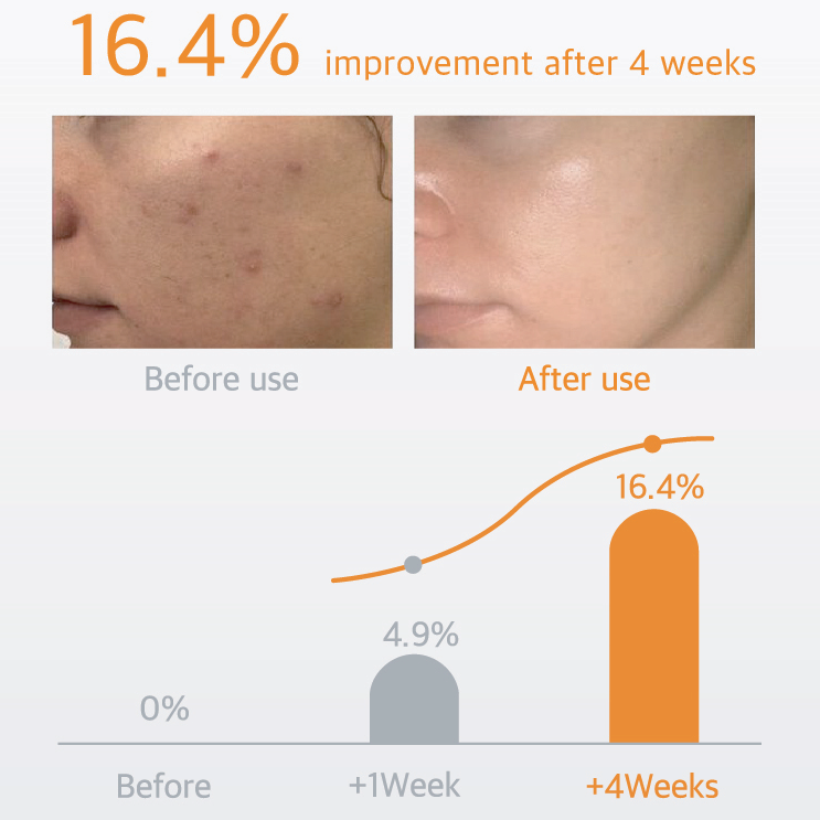 SELASTIN TOX  Anti Wrinkle and Glutathione Whitening Skin Booster
